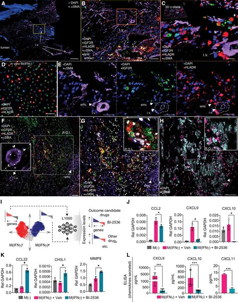 Cellular Heterogeneity Of Activated Primary Human Macrophages And