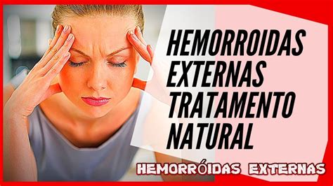 Hemorroidas Externas Saiba A Verdade Sobre As Hemorroidas Externas