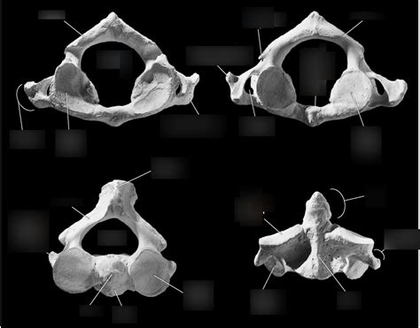 Cervical (C1, C2) Vertebrae Anatomy/Osteology Diagram | Quizlet