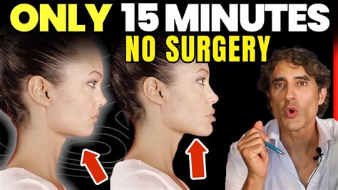 How To Get A More Defined Chin And Jawline In Only Minutes Youtube