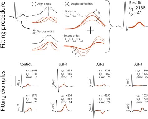 Improving Long Qt Syndrome Diagnosis By A Polynomial Based T Wave