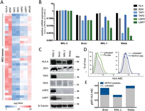 Reduced Hla Class I Expression In Mcc Is Associated With An Impaired