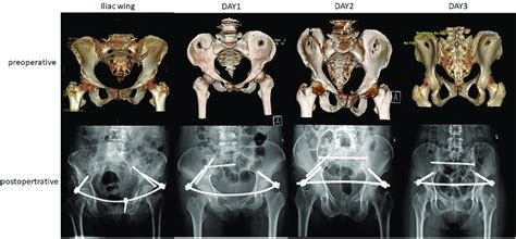 Typical Cases From Each Group With Preoperative And Postoperative Images Download Scientific