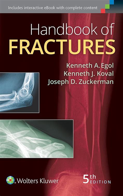 Handbook Of Fractures Egol Kenneth A M D Koval Kenneth J M D