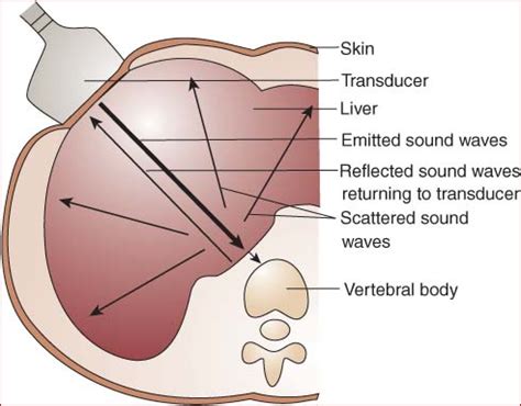 Ultrasound Basics Flashcards Quizlet