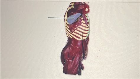 Solved Identify The Highlighted Muscle Chegg