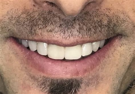 Tratamientos Dentales En Huelva