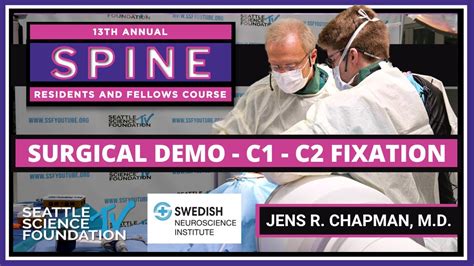 C1 C2 Fixation Jens R Chapman Md And Jim Hicks Md Youtube