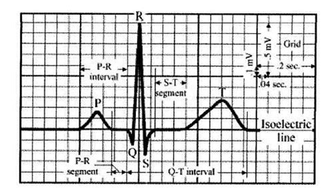 Ecg Tracing Label