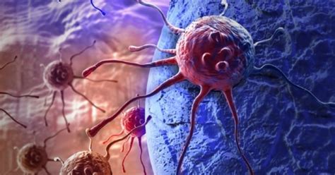 Cancro Scoperta Terapia Che Uccide Le Cellule Tumorali