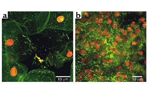 Confocal Scanning Laser Micrographs Of Tissue Recovered From The