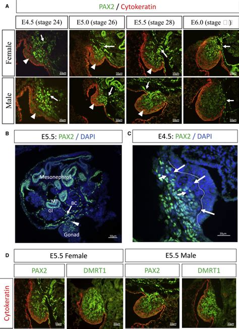 Insights Into Gonadal Sex Differentiation Provided By Single Cell