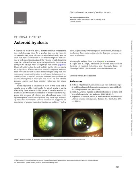 (PDF) Asteroid hyalosis