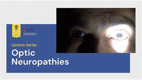 Neuro Ophthalmology Lecture Optic Neuropathies YouTube