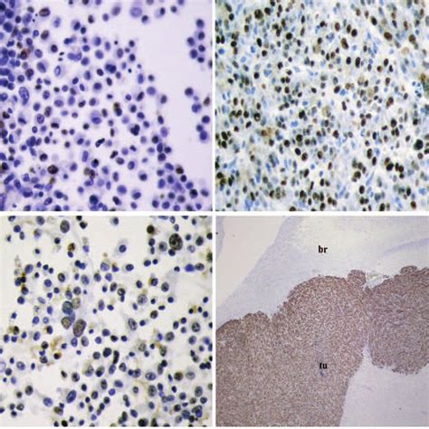 Photographs Of U Human Glioma Cells Grown In Culture As A Monolayer