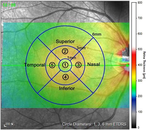 Mean Individual Retinal Layer Thickness Measurement In The Subfields