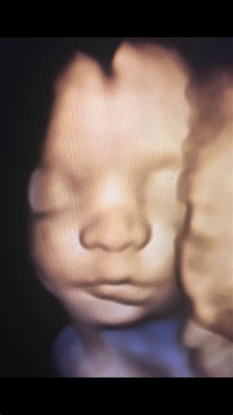 3d/ 4D Baby Ultrasound - Baby Face 4D Ultrasound