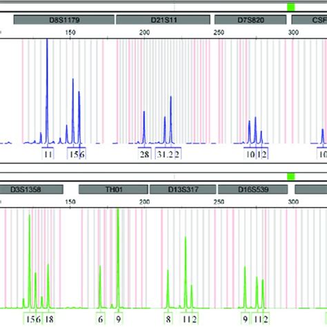 Pdf Importance Of Y Str Profiling In Sexual Assault Cases With Mixed Dna Profile