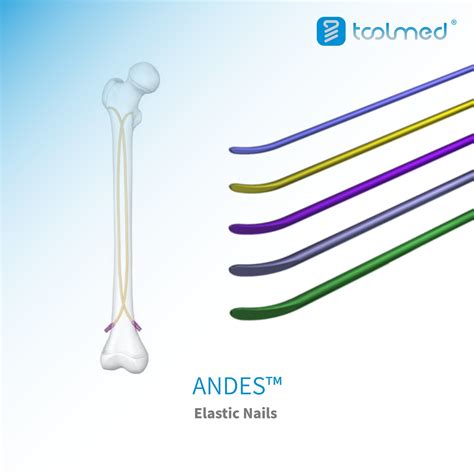 Andes Elastic Nail System Titanium Orthopedic Implant For Trauma