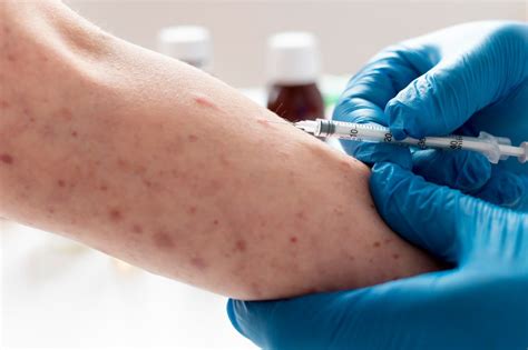 Estados Unidos Confirmam Primeiro Caso De Nova Variante Da Mpox