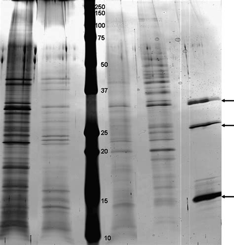 Sds Page Profiles Of Extracellular Matrix Proteins Of The Biofilms Of