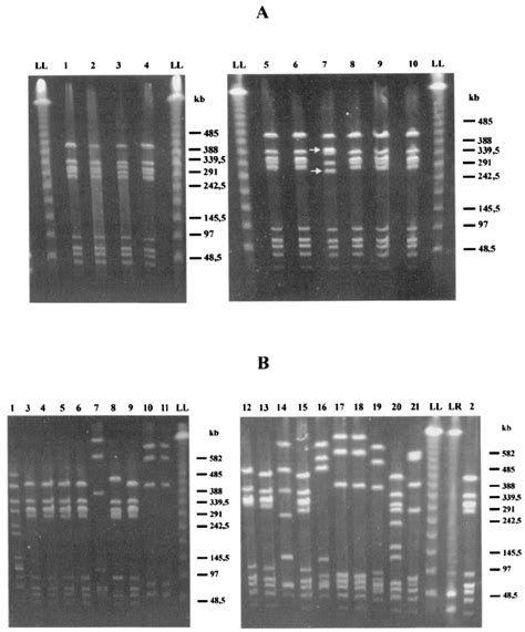 Pfge Of Genomic Dna Of Erythromycin Resistant A And Sensitive B