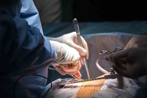 appendix grow   surgery thip media