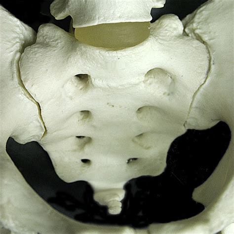 Sacral Vertebrae