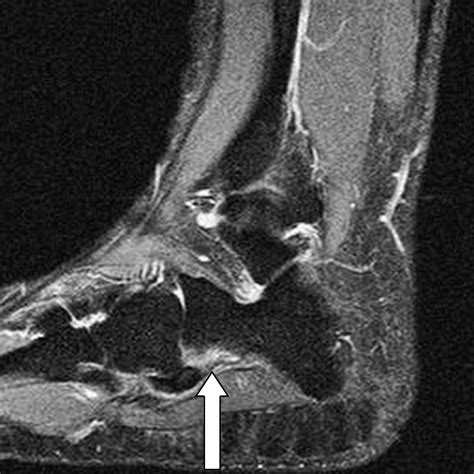 The Importance Of Magnetic Resonance Imaging In A Symptomatic