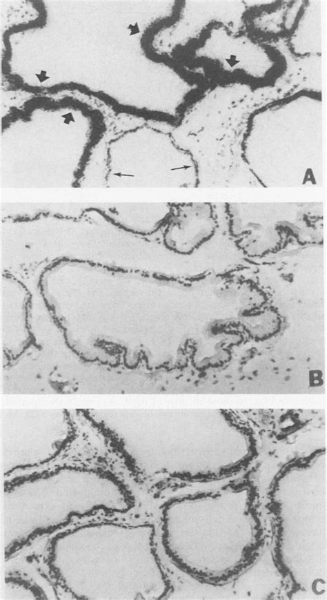 Expression Of TRPM 2 Transcripts In Dying Epithelial Cells During