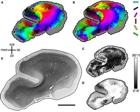 Frontiers Histological Validation Of High Resolution Dti In Human