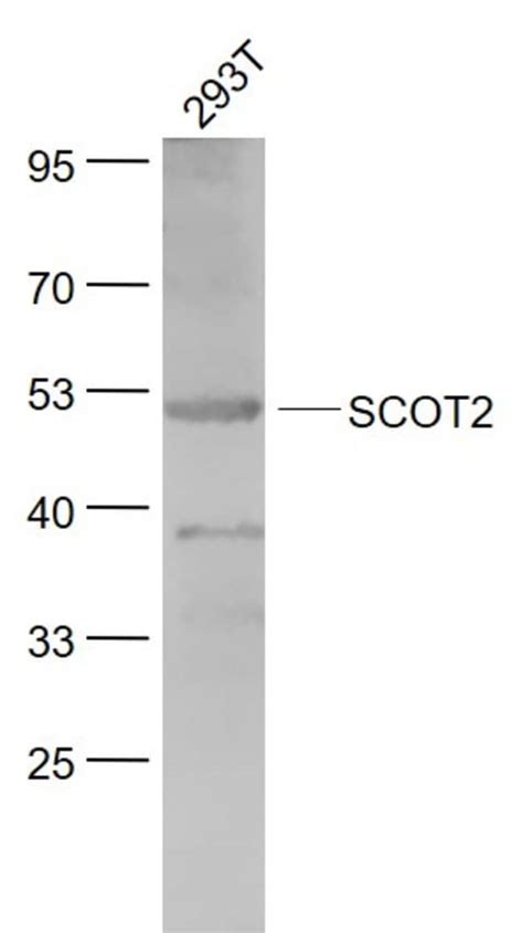 SCOT2 Rabbit anti Human Polyclonal Bioss 100 μL Unconjugated