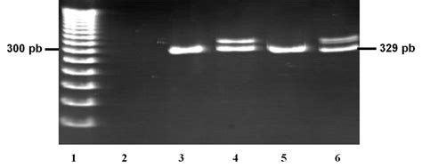 Pcr Products Of Flt Itd Analyzed By Gel Electrophoresis Reverse View