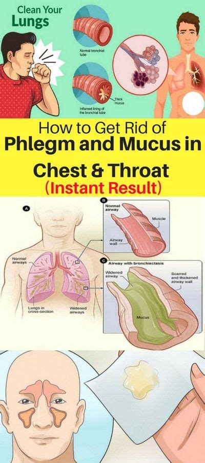 Eliminate Mucus and Phlegm in Throat and Chest With These Natural ...