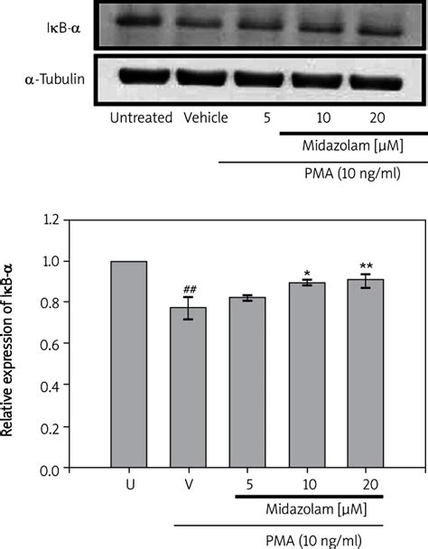 Effects Of Midazolam On Phorbol Myristate Acetate Pma Induced