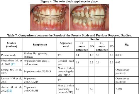 Table 7 From Immediate Effect Of Twin Block Appliance On The Airway On