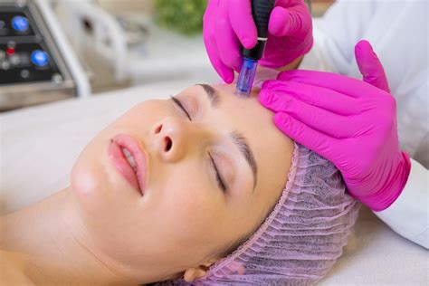 What Is Microneedling And What Are Its Benefits Restoration Clinic