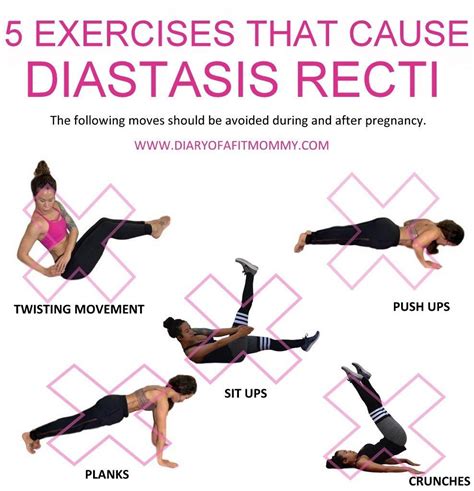 Exercises That Help Diastasis Recti Women Perfectabsworkout