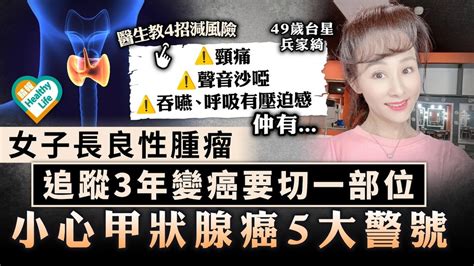 甲狀腺癌｜49歲女良性腫瘤 追蹤3年變癌要切一部位 小心甲狀腺癌5大警號 晴報 健康 腫瘤及癌症 D231119