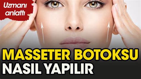 Masseter botoksu nasıl yapılmalı