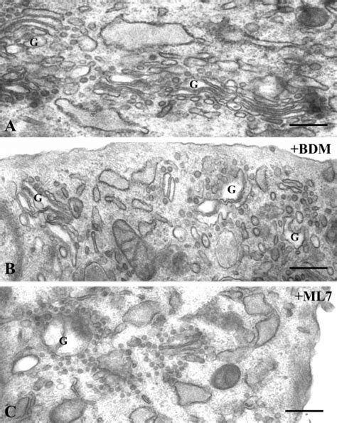 Electron Microscopy Of The Golgi Complex In Untreated A And BDM 40