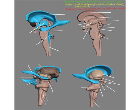Ventricles, Diencephalon, Hindbrain Anatomy Quiz