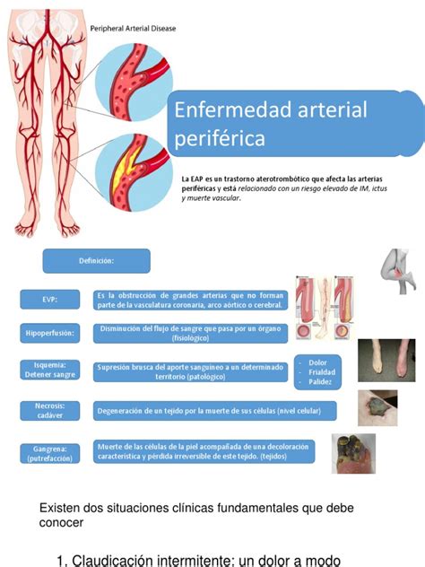 Enfermedad Arterial Periferica Especialidades Medicas Sistema