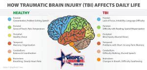 Understanding Traumatic Brain Injuries Hope For The Warriors