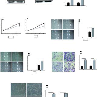 Mir A P Inhibited Crc Progression Via Vegfa Vegfr Signaling