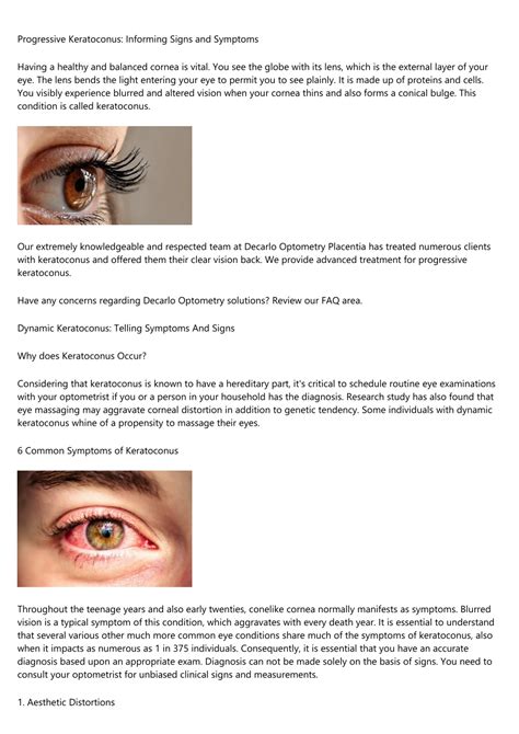 Ppt The Defining Signs Of A Progressive Keratoconus Condition