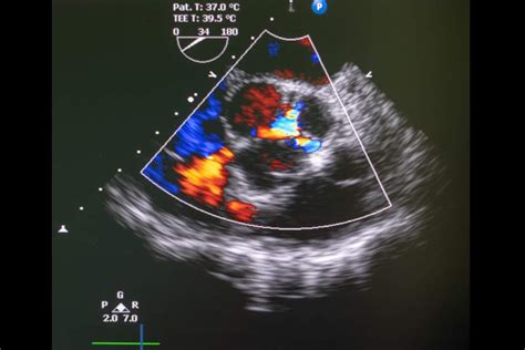 Ecografia Ed Ecocolordoppler Roma Eur Clinical Medical Consulting