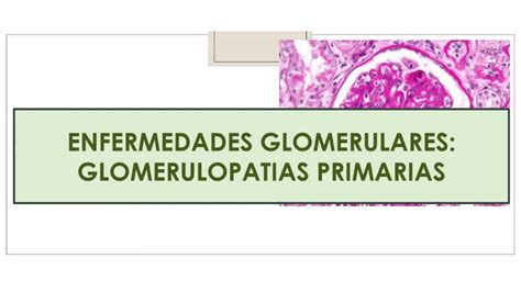 Glomerulopat As Primarias I Liquidoh Udocz