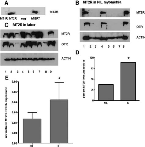 Functional Mel Receptors In The Human Myometrium A Western Blot For