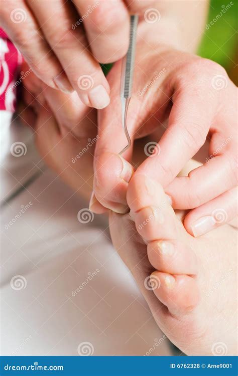 Chiropody Foot Care Stock Photo Image Of Tool Podiatry 6762328